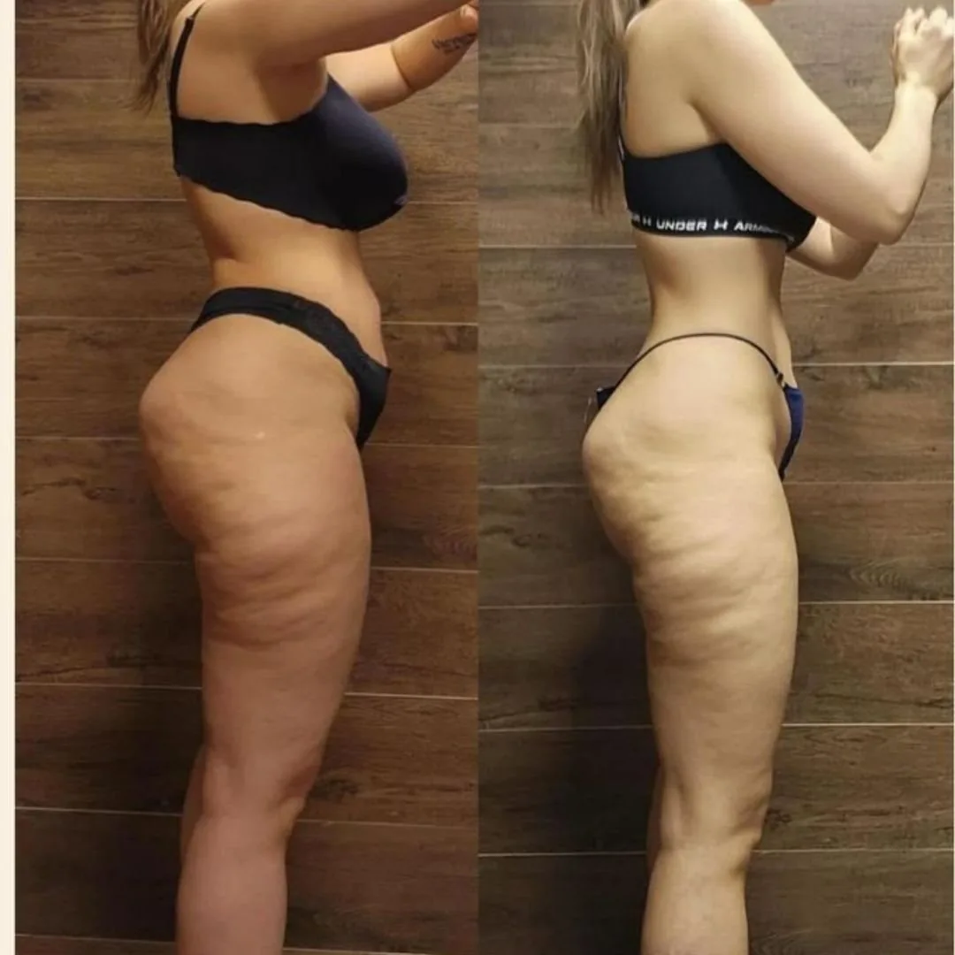 Reader before and after