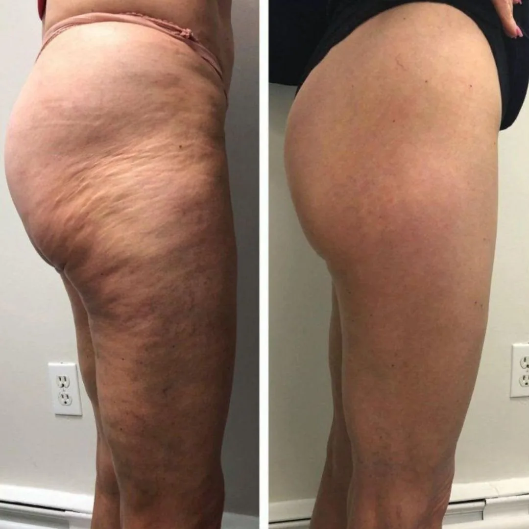 Reader before and after