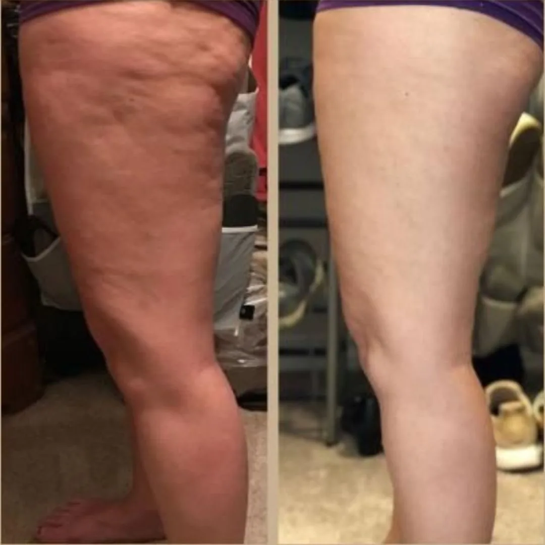 Reader before and after