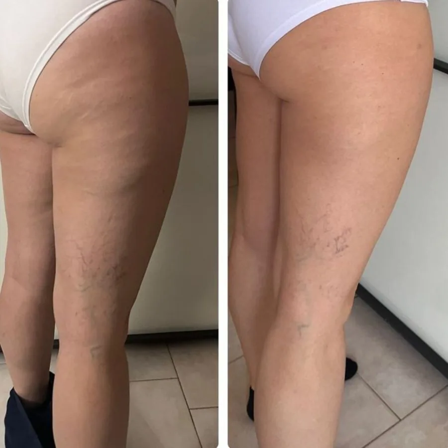 Reader before and after