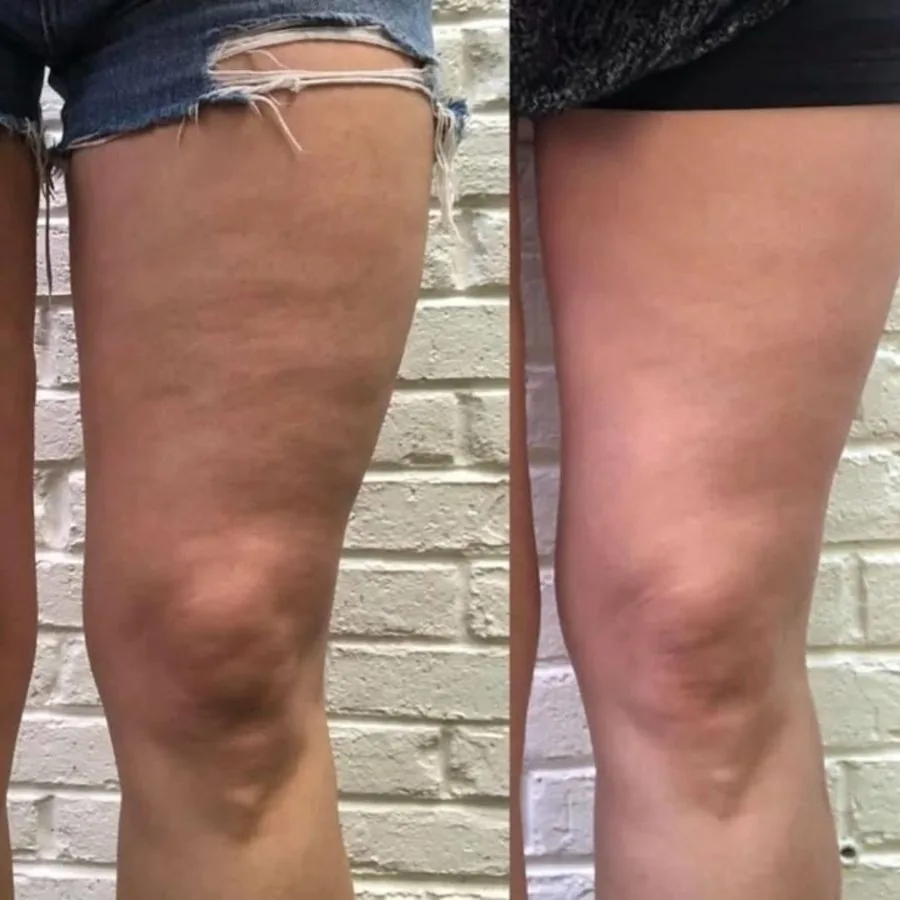 Reader before and after