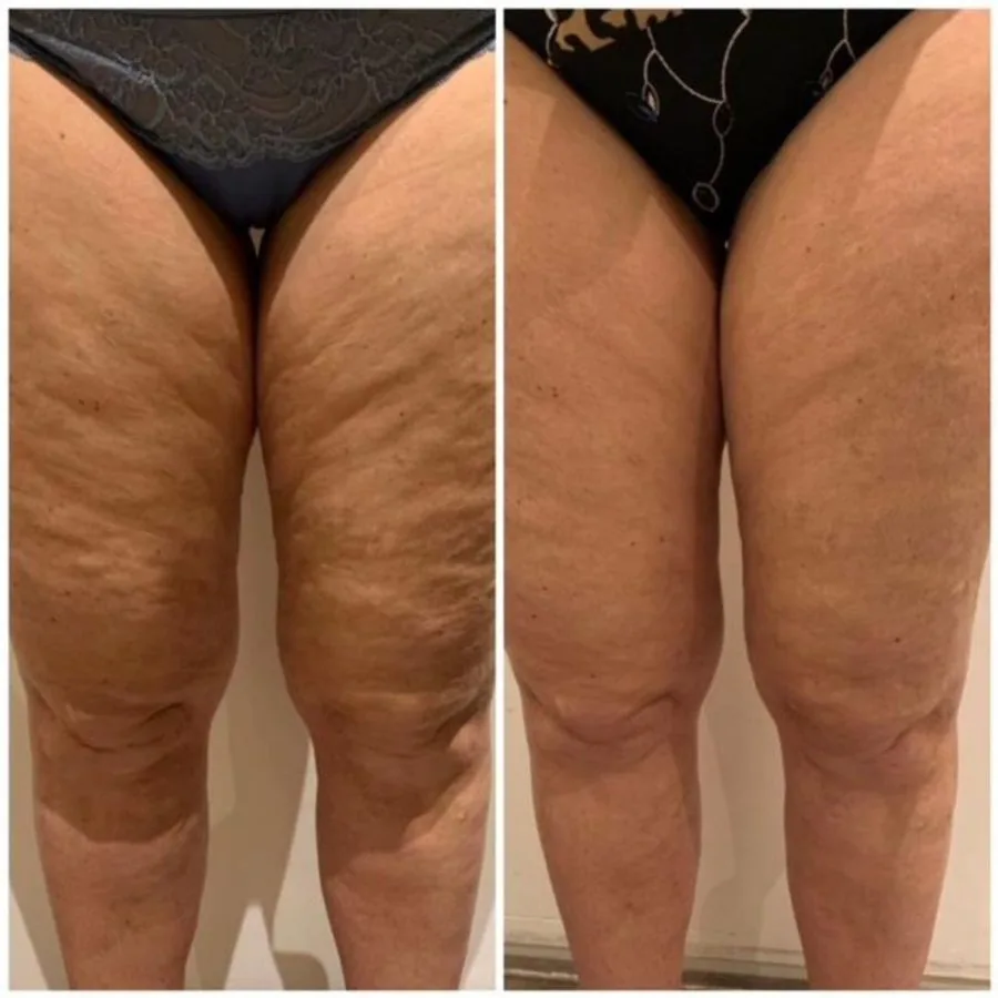 Reader before and after