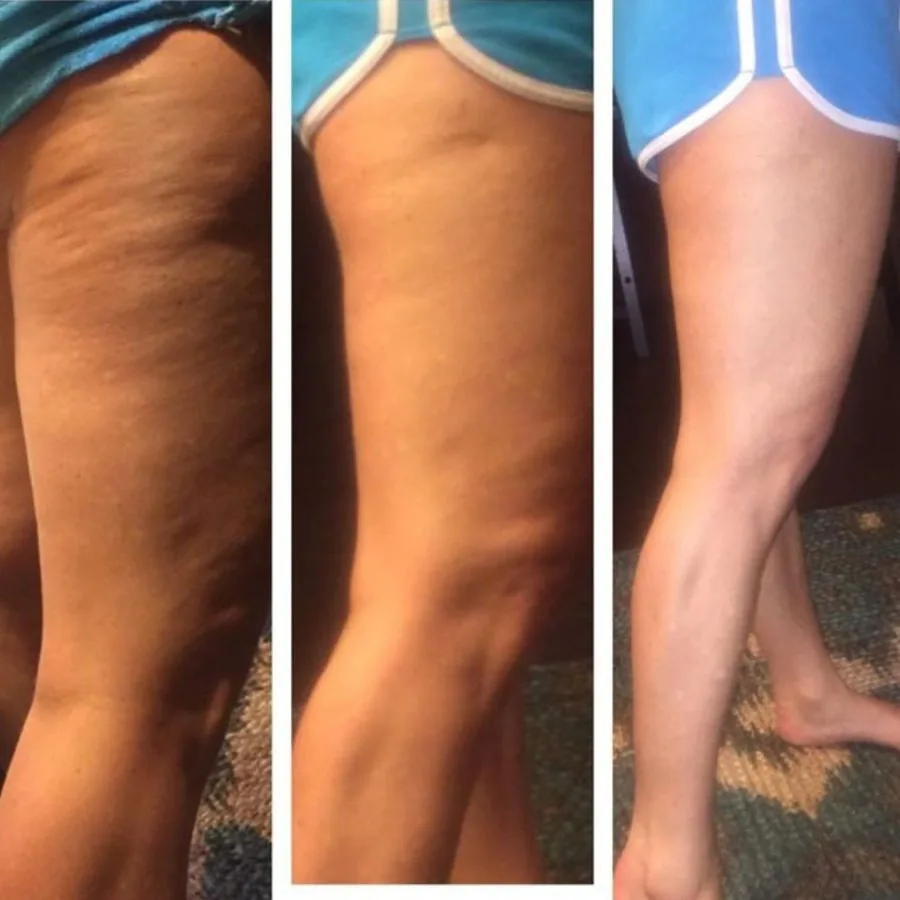 Reader before and after