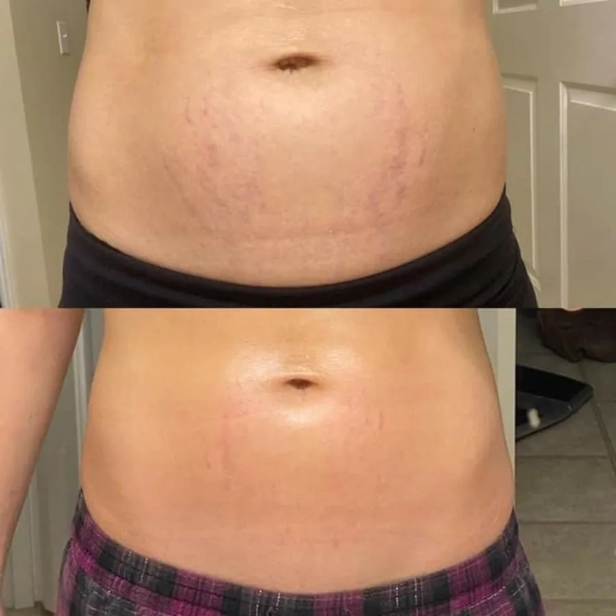 Reader before and after