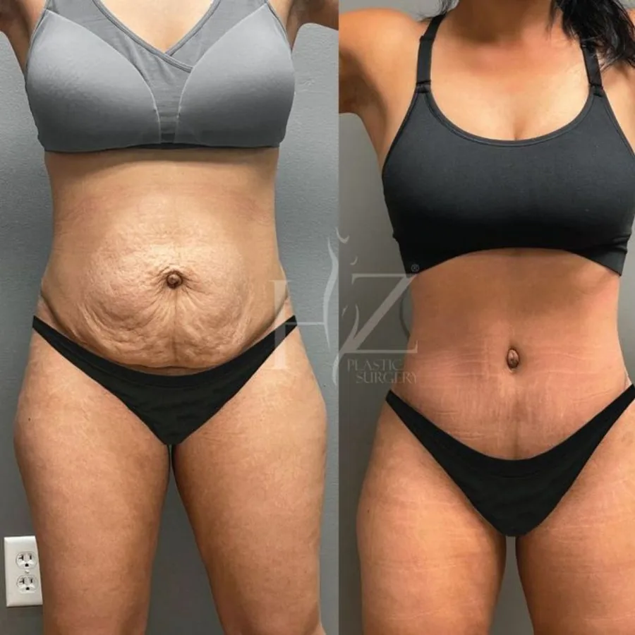Body fat lost, visualized at scale